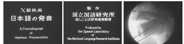 Ｘ線